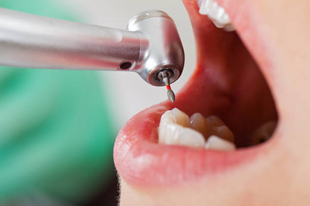 Best After-Hours Dental Trauma Care in Hutto, TX